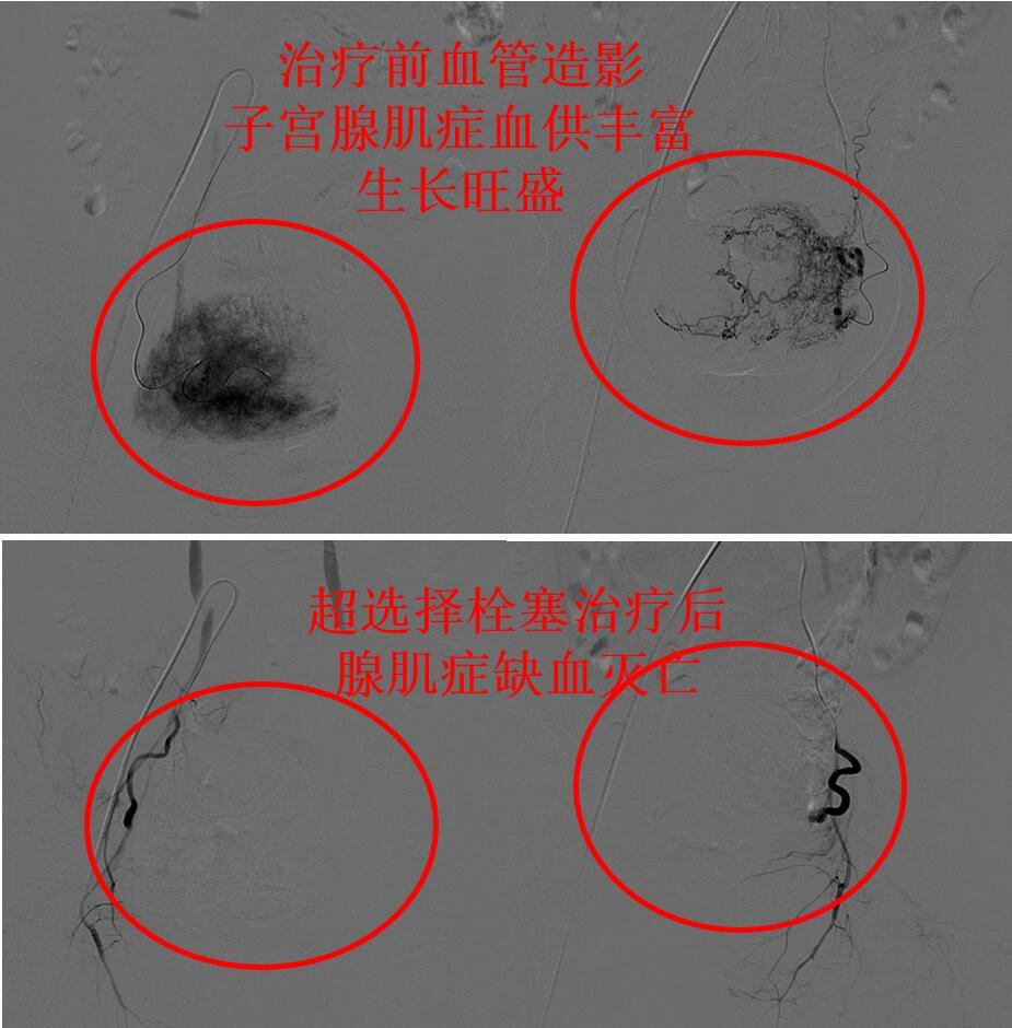 探究五个月出血的原因与应对之策